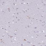 ADAP Polyclonal Antibody