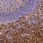 ADAP Antibody in Immunohistochemistry (Paraffin) (IHC (P))