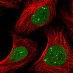 RNF2 Polyclonal Antibody