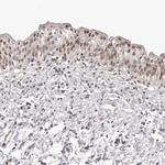 RNF2 Antibody in Immunohistochemistry (Paraffin) (IHC (P))