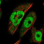 BRCA2 Polyclonal Antibody