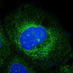 Ribophorin I Polyclonal Antibody