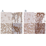 Ribophorin I Antibody in Immunohistochemistry (Paraffin) (IHC (P))