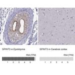 SPINT3 Antibody