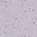 SPINT3 Polyclonal Antibody