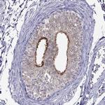 SPINT3 Antibody in Immunohistochemistry (Paraffin) (IHC (P))