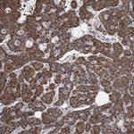 MAN2A1 Antibody in Immunohistochemistry (Paraffin) (IHC (P))