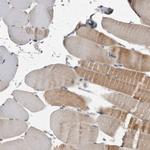 MAN2A1 Polyclonal Antibody