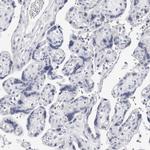 Phospholamban Antibody in Immunohistochemistry (Paraffin) (IHC (P))