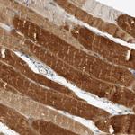 Phospholamban Antibody in Immunohistochemistry (Paraffin) (IHC (P))