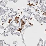 LYAG Antibody in Immunohistochemistry (Paraffin) (IHC (P))