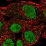 PRDM10 Polyclonal Antibody