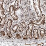 PRDM10 Antibody in Immunohistochemistry (Paraffin) (IHC (P))