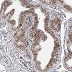 PRDM10 Antibody in Immunohistochemistry (Paraffin) (IHC (P))