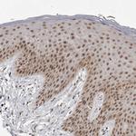 PRDM10 Antibody in Immunohistochemistry (Paraffin) (IHC (P))