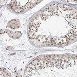PRDM10 Antibody in Immunohistochemistry (Paraffin) (IHC (P))