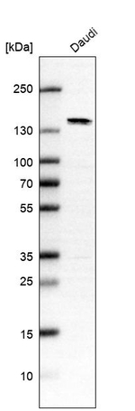 PRDM10 Antibody in Western Blot (WB)