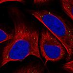 COL26A1 Polyclonal Antibody