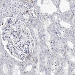 COL26A1 Antibody in Immunohistochemistry (Paraffin) (IHC (P))