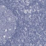 COL26A1 Antibody in Immunohistochemistry (Paraffin) (IHC (P))