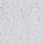 COL26A1 Antibody in Immunohistochemistry (Paraffin) (IHC (P))