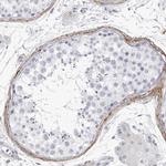 COL26A1 Antibody in Immunohistochemistry (Paraffin) (IHC (P))