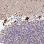 AMPD2 Polyclonal Antibody