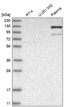 AMPD2 Antibody in Western Blot (WB)