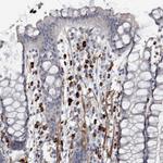 MASTL Antibody in Immunohistochemistry (Paraffin) (IHC (P))
