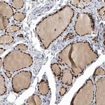 PDCD4 Antibody in Immunohistochemistry (Paraffin) (IHC (P))