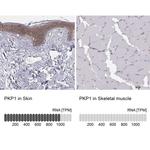 PKP1 Antibody
