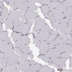 PKP1 Antibody in Immunohistochemistry (Paraffin) (IHC (P))