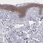 PKP1 Antibody in Immunohistochemistry (Paraffin) (IHC (P))
