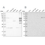 PKP1 Antibody in Western Blot (WB)