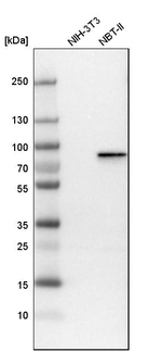 PKP1 Antibody in Western Blot (WB)