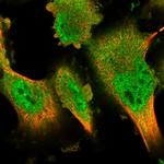 DYRK2 Polyclonal Antibody