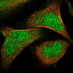 SENP7 Polyclonal Antibody