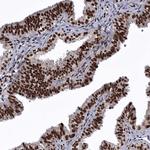 SENP7 Antibody in Immunohistochemistry (Paraffin) (IHC (P))