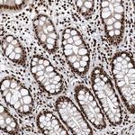 SENP7 Antibody in Immunohistochemistry (Paraffin) (IHC (P))