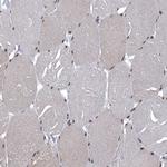 SENP7 Antibody in Immunohistochemistry (Paraffin) (IHC (P))