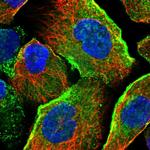 JMJD4 Polyclonal Antibody