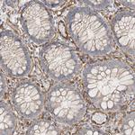JMJD4 Antibody in Immunohistochemistry (Paraffin) (IHC (P))
