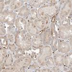 JMJD4 Antibody in Immunohistochemistry (Paraffin) (IHC (P))