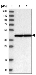 WDR77 Antibody in Western Blot (WB)