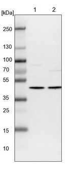 WDR77 Antibody in Western Blot (WB)