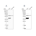 TCP1 Antibody in Western Blot (WB)