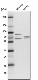 TCP1 Antibody in Western Blot (WB)