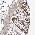 Fumarase Antibody in Immunohistochemistry (Paraffin) (IHC (P))