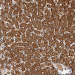 Fumarase Antibody in Immunohistochemistry (Paraffin) (IHC (P))