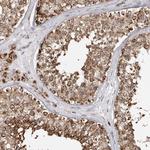 Fumarase Antibody in Immunohistochemistry (Paraffin) (IHC (P))